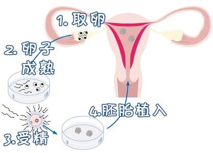 代生选性别包生男孩